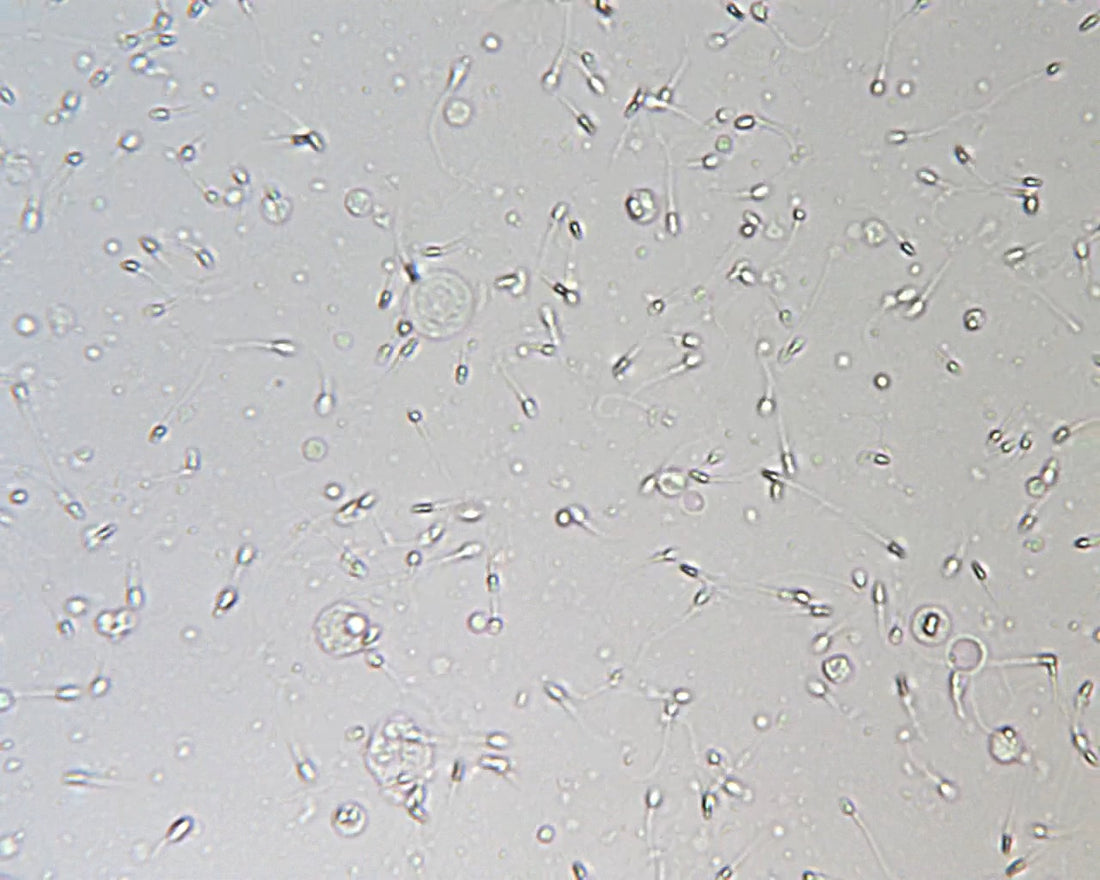 Image of sperm swimming with gray background 