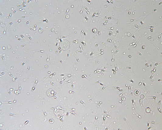 Image of sperm swimming with gray background 