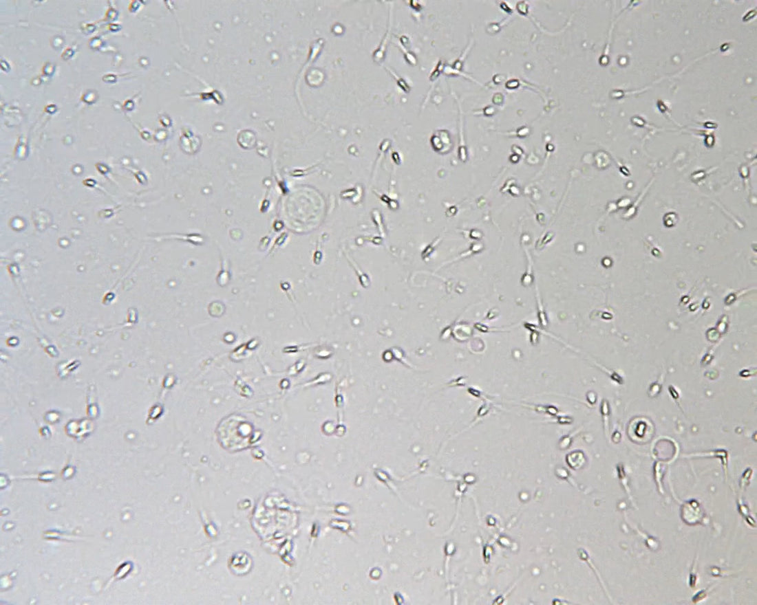 Image of sperm swimming with gray background 