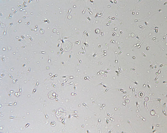 Image of sperm swimming with gray background 